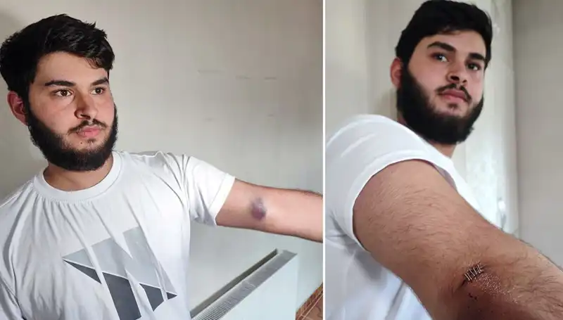 Bahçeye Kaçan Top, Mahallede Kaos Ortaya Çıkardı!