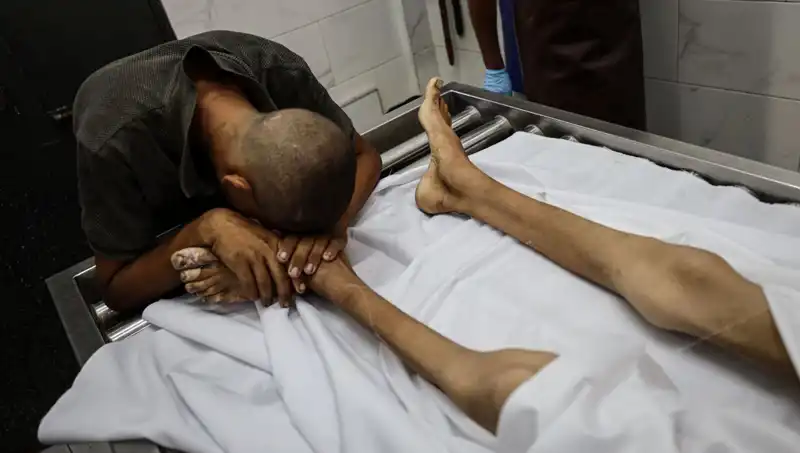 Gazze'deki Çocukların Açlık Dramı: Bir Küçük Hayat Daha Kaybedildi