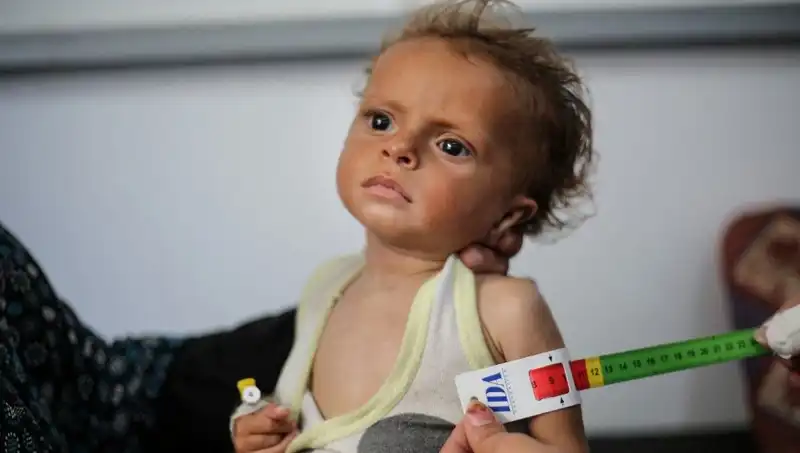 İngiltere, Gazze'deki 300 Çocuğa Yeni Bir Gelecek Sunacak